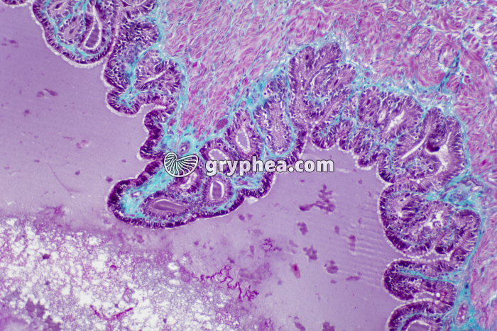 Vésicule séminale x40 - gryphea.com